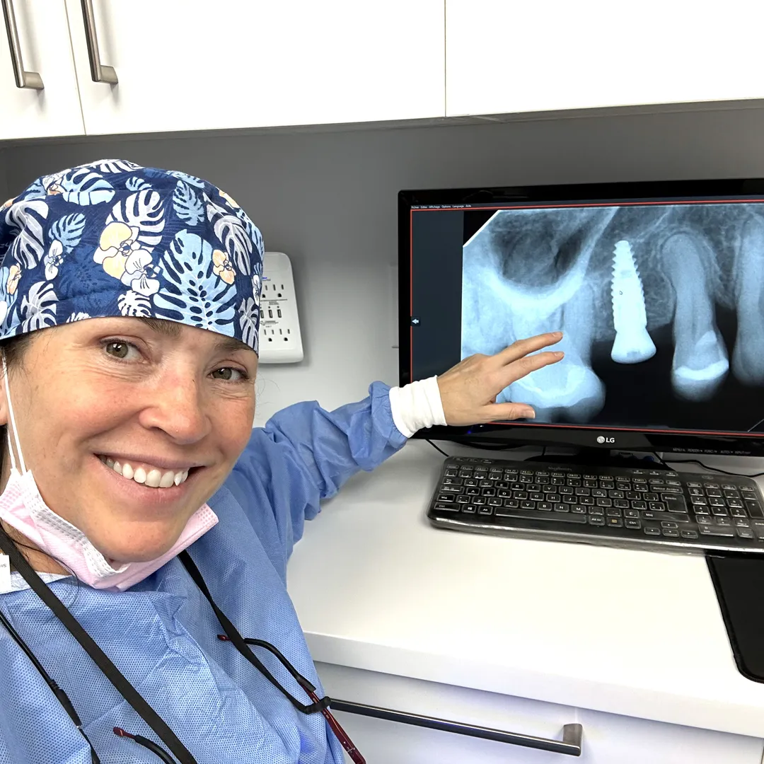 implantologie - Dentisterie Tiraloche